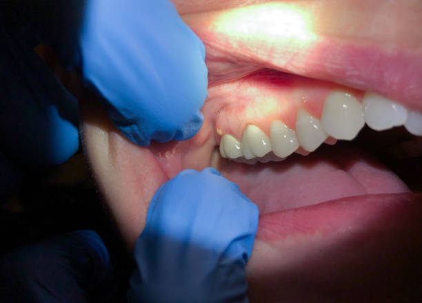 Best Cracked Tooth Emergency Dentist  in San Elizario, TX