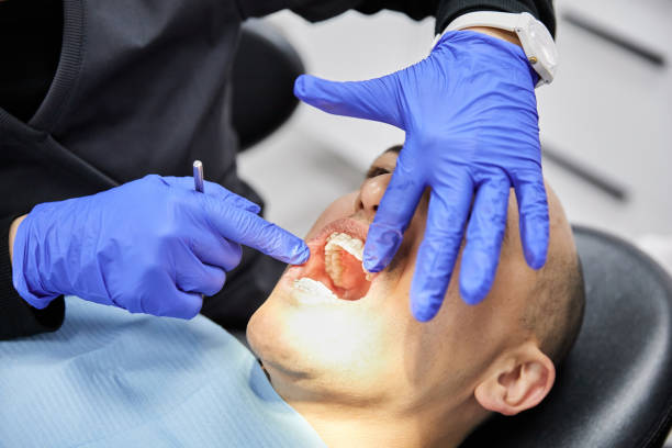Best Tooth Infection Emergency Dentist  in San Elizario, TX